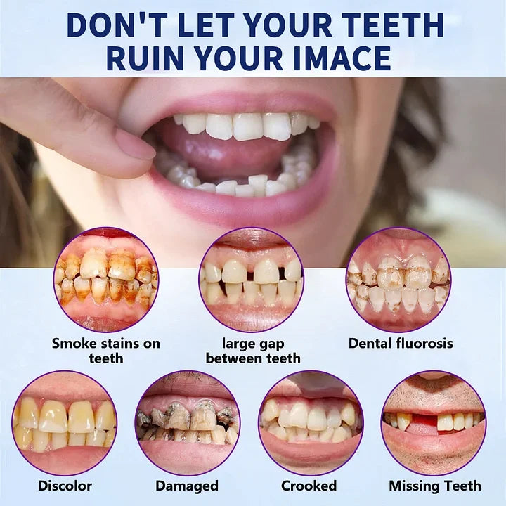 SmileFitPro™ – Lösung der neuen Generation: Flexible Vollprothese